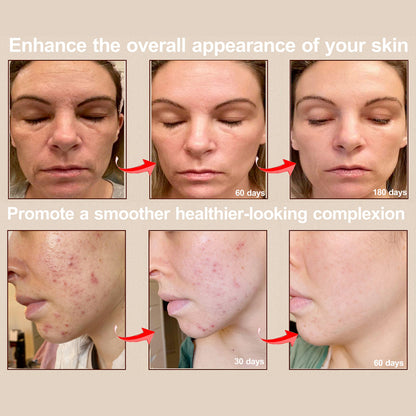 Facemask Light Therapy